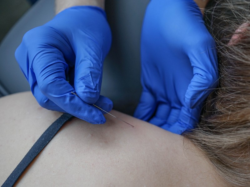 igłoterapia białystok